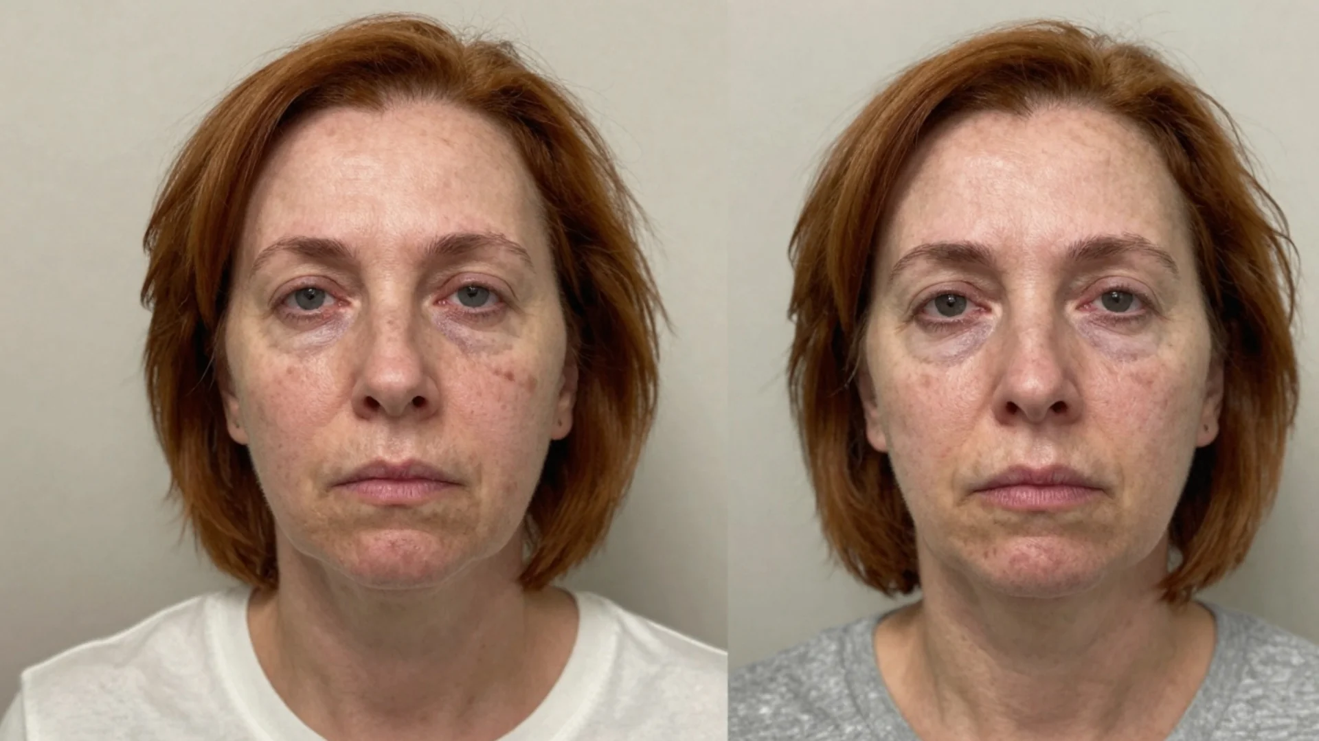 Before and after buccal massage - client 2